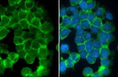 Immunocytochemistry/Immunofluorescence: Desmoglein-2 Antibody [NBP1-33374] - A431 cells were fixed in 4% paraformaldehyde at RT for 15 min. Green: Desmoglein 2 stained by Desmoglein 2 antibody [N1N2], N-term  diluted at 1:500. Blue: Fluoroshield with DAPI.  