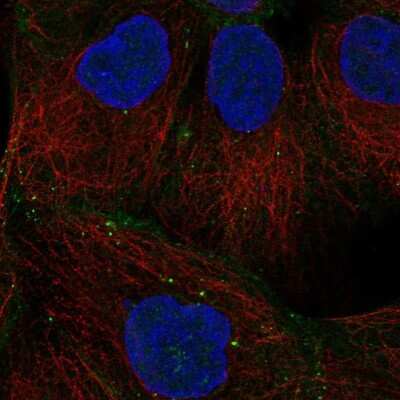 Immunocytochemistry/Immunofluorescence: Desmoglein-2 Antibody [NBP1-85709] - Staining of human cell line A-431 shows localization to plasma membrane, cell junctions & vesicles. Antibody staining is shown in green.