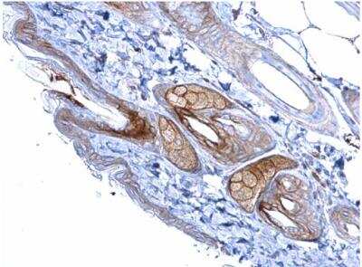 Immunohistochemistry-Paraffin: Desmoglein-2 Antibody [NBP1-33374] - Mouse skin. Desmoglein 2 antibody [N1N2], N-term  diluted at 1:500. Antigen Retrieval: Trilogy™ (EDTA based, pH 8.0) buffer, 15min. 