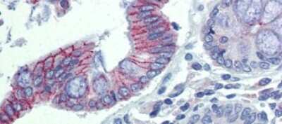 Immunohistochemistry-Paraffin: Desmoglein 2 Antibody [NBP1-59200] - Human Colon tissue at an antibody concentration of 5.0ug/ml.