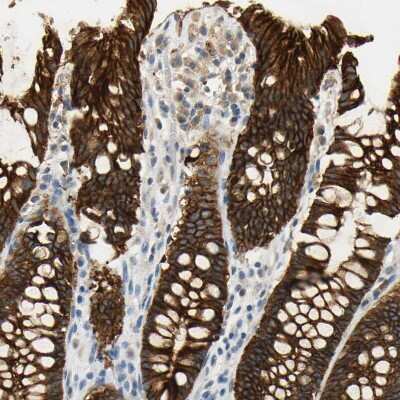 Immunohistochemistry-Paraffin: Desmoglein-2 Antibody [NBP1-85709] - Staining of human rectum shows strong membranous positivity in glandular cells.