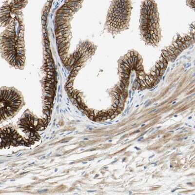 Immunohistochemistry-Paraffin: Desmoglein-2 Antibody [NBP1-85709] - Staining of human prostate shows moderate to strong membranous positivity in glandular cells.