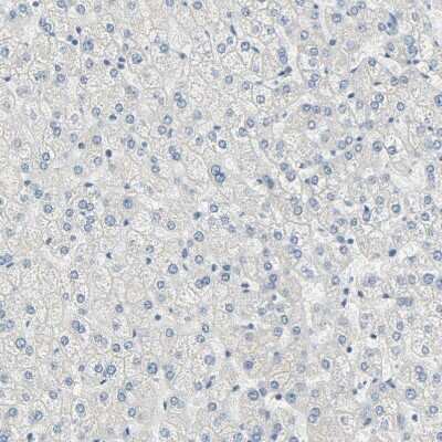 Immunohistochemistry-Paraffin: Desmoglein-2 Antibody [NBP1-85709] - Staining of human liver shows no positivity in hepatocytes as expected.