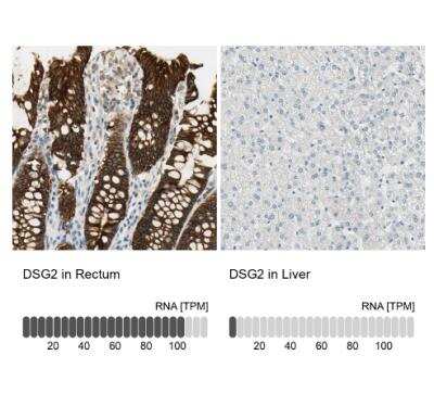 Immunohistochemistry-Paraffin: Desmoglein-2 Antibody [NBP1-85709] - Analysis in human rectum and liver tissues using NBP1-85709 antibody. Corresponding DSG2 RNA-seq data are presented for the same tissues.