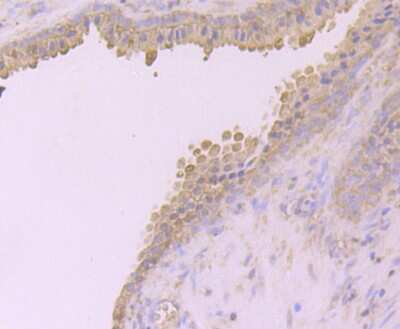 Immunohistochemistry-Paraffin: Desmoglein-2 Antibody (JB96-37) [NBP2-75469] - Analysis of paraffin-embedded human prostate tissue using anti-Desmoglein 2 antibody. Counter stained with hematoxylin.