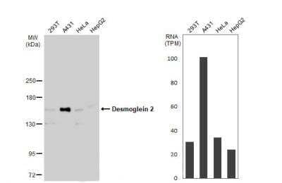 Western Blot: Desmoglein-2 Antibody [NBP1-33374] - Various whole cell extracts (30 ug) were separated by 5% SDS-PAGE, and the membrane was blotted with Desmoglein-2 antibody diluted at 1:500. HRP-conjugated anti-rabbit IgG antibody was used to detect the primary antibody.