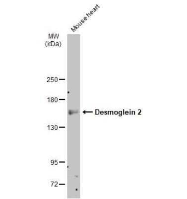 Western Blot: Desmoglein-2 Antibody [NBP1-33374] - Mouse tissue extract (50 ug) was separated by 5% SDS-PAGE, and the membrane was blotted with Desmoglein 2 antibody [N1N2], N-term diluted at 1:500. The HRP-conjugated anti-rabbit IgG antibody (NBP2-19301) was used to detect the primary antibody.