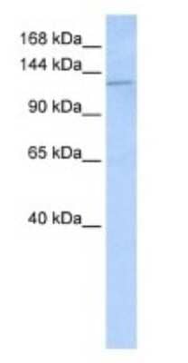 Western Blot: Desmoglein 2 Antibody [NBP1-59200] - Titration: 1 ug/ml Positive Control: Hela cell lysate.