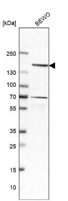 <b>Orthogonal Strategies Validation. </b>Western Blot: Desmoglein-2 Antibody [NBP1-85709] - Analysis in human cell line BEWO.