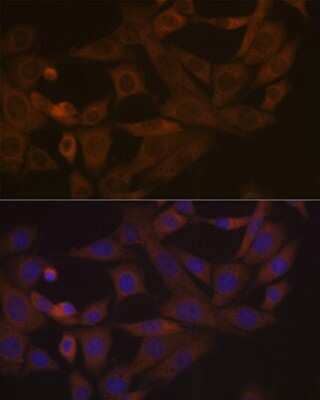 Immunocytochemistry/Immunofluorescence: Desmoglein-3 Antibody (1T1D5) [NBP3-16597] - Immunofluorescence analysis of NIH-3T3 cells using Desmoglein-3 Rabbit mAb (NBP3-16597) at dilution of 1:100 (40x lens). Blue: DAPI for nuclear staining.