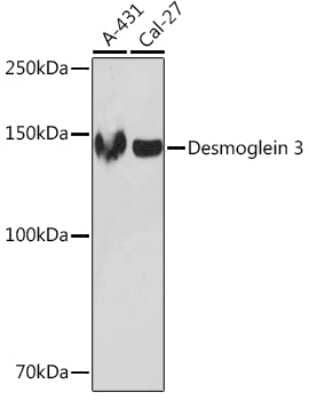 Western Blot: Desmoglein-3 Antibody (1T1D5) [NBP3-16597] - Western blot analysis of extracts of various cell lines, using Desmoglein-3 Rabbit mAb (NBP3-16597) at 1:1000 dilution. Secondary antibody: HRP Goat Anti-Rabbit IgG (H+L) at 1:10000 dilution. Lysates/proteins: 25ug per lane. Blocking buffer: 3% nonfat dry milk in TBST. Detection: ECL Enhanced Kit. Exposure time: 3min.