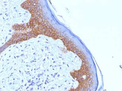 Immunohistochemistry-Paraffin: Desmoglein-3 Antibody (5G11) - Azide and BSA Free [NBP3-08408] - Formalin-fixed, paraffin-embedded human Skin stained with Desmoglein-3 Monoclonal Antibody (5G11).