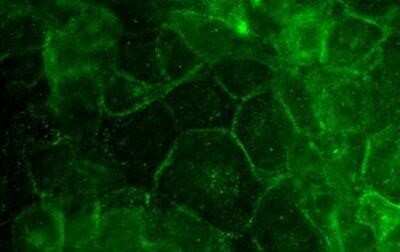 Immunocytochemistry/Immunofluorescence: Desmoglein-3 Antibody (5H10) - Azide and BSA Free [NBP2-80695] - Desmoglein 3 (5H10) antibody was tested in oral HNSCC cells fixed with 1% formaldehyde permeabilized in 0.1% Triton X-100. Image from the standard format of this antibody.