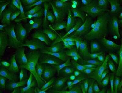 Immunocytochemistry/Immunofluorescence: Desmoglein-3 Antibody (5H10) - Azide and BSA Free [NBP2-80695] - The cultured primary mouse skin keratinocytes were stained at 1:150. The image shows the cytosolic staining. This image was submitted via customer review. Image from the standard format of this antibody.