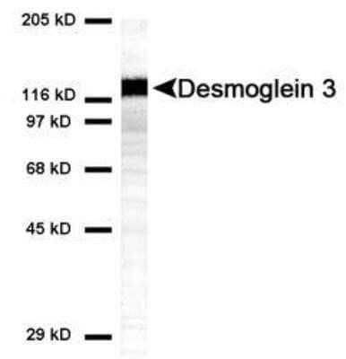 Western Blot: Desmoglein-3 Antibody (5H10) - Azide and BSA Free [NBP2-80695] - Analysis of Desmoglein 3 expression in HaCat cell lysate using NBP1-78984. Image from the standard format of this antibody.