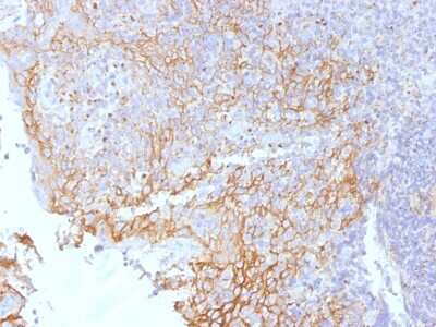 Immunohistochemistry-Paraffin: Desmoglein-3 Antibody (5H10) [NBP2-54596] - Formalin-fixed, paraffin-embedded human Tonsil stained with Beta-Catenin (p120) Monoclonal Antibody (5H10).