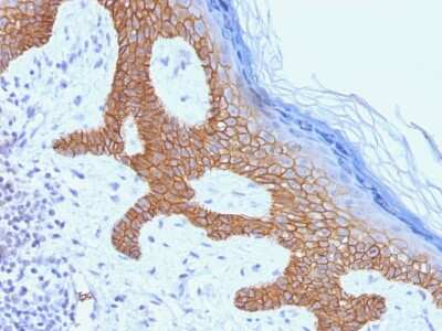 Immunohistochemistry-Paraffin: Desmoglein-3 Antibody (DSG3/1535) [NBP3-07873] - Formalin-fixed, paraffin-embedded human Skin stained with Desmoglein-3 Monoclonal Antibody (DSG3/1535).