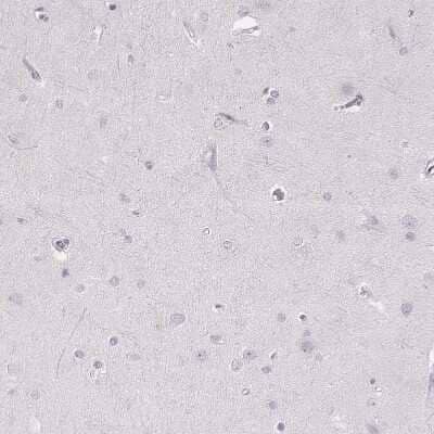 Immunohistochemistry-Paraffin: Desmoglein-4 Antibody [NBP2-31770] - Staining of human cerebral cortex shows no positivity in neurons as expected.