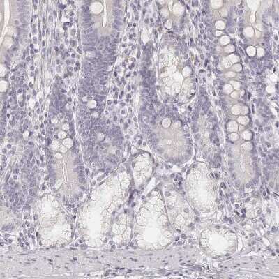 Immunohistochemistry-Paraffin: Desmoglein-4 Antibody [NBP2-31770] - Staining of human duodenum shows no positivity in glandular cells as expected.