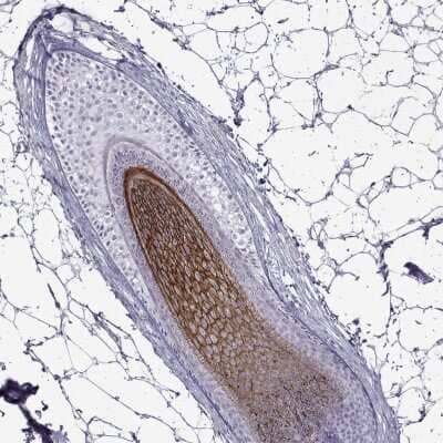 Immunohistochemistry-Paraffin: Desmoglein-4 Antibody [NBP2-31770] - Staining of human skin show strong membranous positivity in hair follicle.