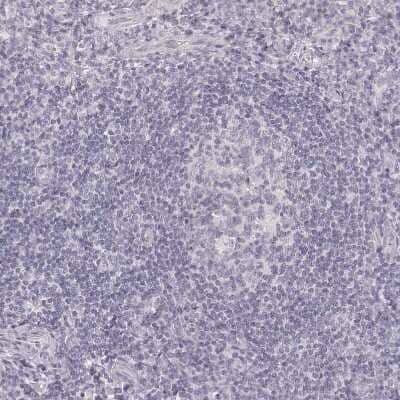 Immunohistochemistry-Paraffin: Desmoglein-4 Antibody [NBP2-31770] - Staining of human tonsil shows no positivity in non-germinal center cells as expected.