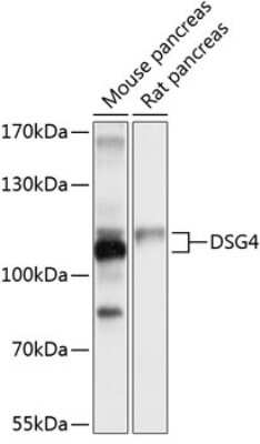 Western Blot: Desmoglein-4 Antibody [NBP2-92025] - Analysis of extracts of various cell lines, using Desmoglein-4 at 1:1000 dilution.Secondary antibody: HRP Goat Anti-Rabbit IgG (H+L) at 1:10000 dilution.Lysates/proteins: 25ug per lane.Blocking buffer: 3% nonfat dry milk in TBST.Detection: ECL Basic Kit .Exposure time: 1s.