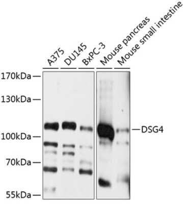 Western Blot: Desmoglein-4 Antibody [NBP2-92025] - Analysis of extracts of various cell lines, using Desmoglein-4 at 1:1000 dilution.Secondary antibody: HRP Goat Anti-Rabbit IgG (H+L) at 1:10000 dilution.Lysates/proteins: 25ug per lane.Blocking buffer: 3% nonfat dry milk in TBST.Detection: ECL Basic Kit .Exposure time: 1s.