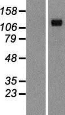 Western Blot: Desmoglein 4 Overexpression Lysate (Adult Normal) [NBP2-05007] Left-Empty vector transfected control cell lysate (HEK293 cell lysate); Right -Over-expression Lysate for Desmoglein 4.