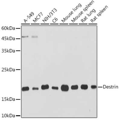 Western Blot: Destrin Antibody (4F9Q1) [NBP3-15907] - Western blot analysis of extracts of various cell lines, using Destrin Rabbit mAb (NBP3-15907) at 1:1000 dilution. Secondary antibody: HRP Goat Anti-Rabbit IgG (H+L) at 1:10000 dilution. Lysates/proteins: 25ug per lane. Blocking buffer: 3% nonfat dry milk in TBST. Detection: ECL Basic Kit. Exposure time: 30s.