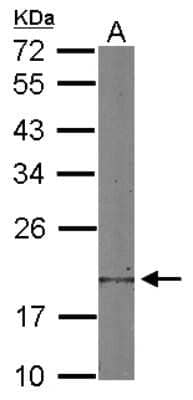 Western Blot: Destrin Antibody [NBP2-16154] - Sample (30 ug of whole cell lysate) A: NIH-3T3 12% SDS PAGE gel, diluted at 1:2000.