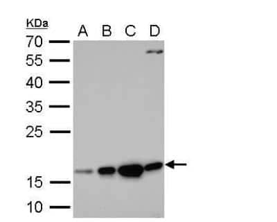 Western Blot: Destrin Antibody [NBP2-16154] - A. 30 ug 293T whole cell lysate/extract B. 30 ug A431 whole cell lysate/extractC. 30 ug HeLa whole cell lysate/extract D. 30 ug HepG2 whole cell lysate/extract12 % SDS-PAGE Destrin antibody dilution: 1:500