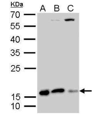 Western Blot: Destrin Antibody [NBP2-16154] - A. 30 ug A549 whole cell lysate/extract B. 30 ug H1299 whole cell lysate/extractC. 30 ug HCT116 whole cell lysate/extract 12 % SDS-PAGE Destrin antibody dilution: 1:500