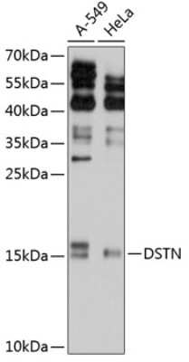 Western Blot: Destrin Antibody [NBP2-92042] - Analysis of extracts of various cell lines, using Destrin .Exposure time: 90s.