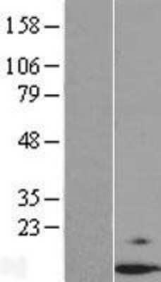 Western Blot: Dexras1 Overexpression Lysate (Adult Normal) [NBP2-07092] Left-Empty vector transfected control cell lysate (HEK293 cell lysate); Right -Over-expression Lysate for Dexras1.