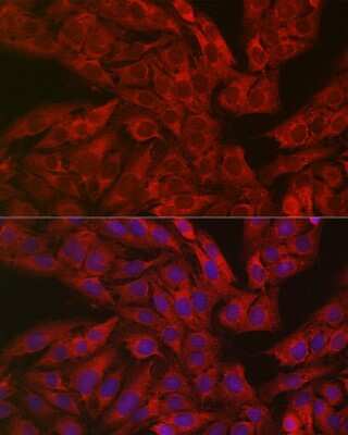 Immunocytochemistry/Immunofluorescence: Dfna5 Antibody [NBP2-92914] - Immunofluorescence analysis of U2OS cells using Dfna5 antibody (NBP2-92914) at dilution of 1:50. Blue: DAPI for nuclear staining.