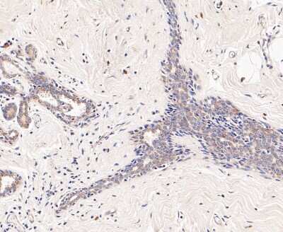 Immunohistochemistry-Paraffin: Dfna5 Antibody [NBP2-80426] - Analysis in human breast tissue using Dfna5 antibody. The section was pre-treated using heat mediated antigen retrieval with Tris-EDTA buffer (pH 8.0-8.4) for 20 minutes. The tissues were blocked in 5% BSA for 30 minutes at room temperature, wash