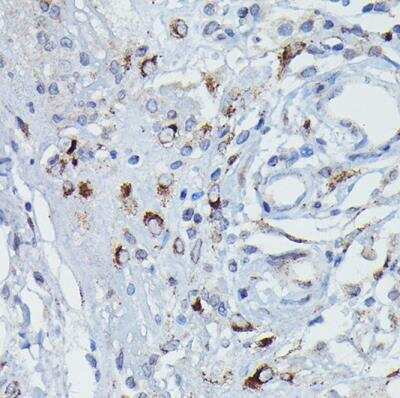 Immunohistochemistry-Paraffin Dfna5 Antibody - Azide and BSA Free