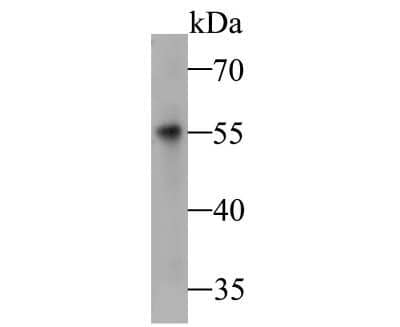 Western Blot Dfna5 Antibody