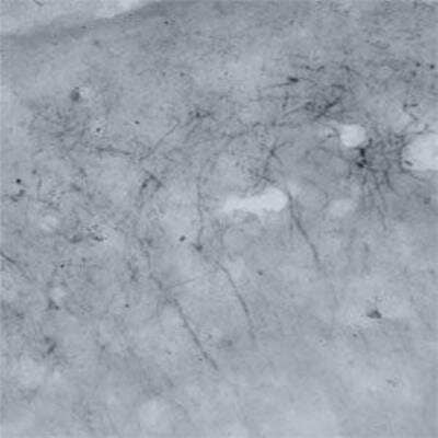 Immunohistochemistry: Dfna5 Antibody [NB110-75027] - IHC on mouse brain using Rabbit antibody to mouse Dfna5 (non-syndromic hearing impairment protein 5 homolog): whole serum at 1 : 500 dilution, incubated overnight and developed with DAB Ni. Nerve fibers are intensely stained.