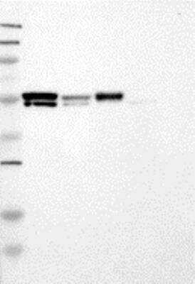 Western Blot: Dfna5 Antibody [28490002] - Samples: Lane 1: Marker [kDa]: 250, 130, 95, 72, 55, 36, 28, 17, 11 / Lane 2: RT-4 / Lane 3: U-251MG sp / Lane 4: Human Plasma / Lane 5: Liver / Lane 6: Tonsil; Target weight [kDa]: 55