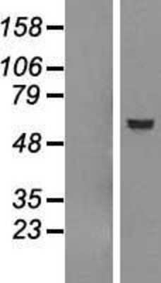 Western Blot Dfna5 Overexpression Lysate