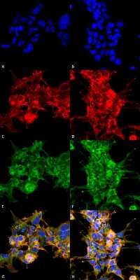 Immunocytochemistry/Immunofluorescence: Dibromo-tyrosine Antibody (6G3) [NBP2-59350] - Immunocytochemistry/Immunofluorescence analysis using Mouse Anti-Dibromo-tyrosine Monoclonal Antibody, Clone 6G3 (NBP2-59350). Tissue: Embryonic kidney epithelial cell line (HEK293). Species: Human. Fixation: 5% Formaldehyde for 5 min. Primary Antibody: Mouse Anti-Dibromo-tyrosine Monoclonal Antibody (NBP2-59350) at 1:50 for 30-60 min at RT. Secondary Antibody: Goat Anti-Mouse Alexa Fluor 488 at 1:1500 for 30-60 min at RT. Counterstain: Phalloidin Alexa Fluor 633 F-Actin stain; DAPI (blue) nuclear stain at 1:250, 1:50000 for 30-60 min at RT. Magnification: 20X (2X Zoom). (A,C,E,G) - Untreated. (B,D,F,H) - Cells cultured overnight with 50 M H2O2. (A,B) DAPI (blue) nuclear stain. (C,D) Phalloidin Alexa Fluor 633 F-Actin stain. (E,F) Dibromo-tyrosine Antibody. (G,H) Composite. Courtesy of: Dr. Robert Burke, University of Victoria.