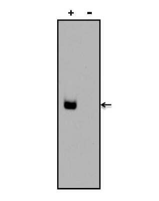 Chemiluminescence Immunoassay: Digoxin Antibody (25P1C9) [NBP1-78617] - Chemiluminescent detection of a Digoxin-labeled oligonucleotide was performed by diluting a Digoxin-labeled DNA oligonucleotide (+) or an unlabeled oligonucleotide control (-) in TriTracker Loading Dye, and loading 5pmols onto a 6% DNA Retardation Gel. DNA was transferred to a Biodyne B membrane and blocked for 30 minutes at room temperature. Digoxin was detected using a Digoxin monoclonal antibody at a dilution of 1ug/ml for 30 minutes at room temperature, followed by a goat anti-mouse IgG-HRP secondary antibody at a dilution of 1:10,000 for at least 30 minutes at room temperature. Chemiluminescent detection was performed using the Chemiluminescent Nucleic Acid Chemiluminescent detection Module Kit.