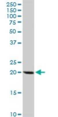 Western Blot: Dihydrofolate Reductase/DHFR Antibody [H00001719-D01P] - Analysis of DHFR expression in Jurkat.