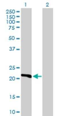 Western Blot: Dihydrofolate Reductase/DHFR Antibody [H00001719-D01P] - Analysis of DHFR expression in transfected 293T cell line by DHFR polyclonal antibody.Lane 1: DHFR transfected lysate(21.50 KDa).Lane 2: Non-transfected lysate.