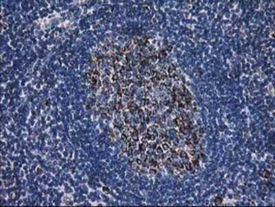 Immunohistochemistry: Dihydrolipoamide Dehydrogenase/DLD Antibody (OTI6D5) - Azide and BSA Free [NBP2-70574] - Staining of paraffin-embedded Human lymph node tissue using anti-Lipoamide Dehydrogenase mouse monoclonal antibody.