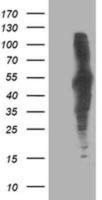 Western Blot: Dihydrolipoamide Dehydrogenase/DLD Antibody (OTI6D5) - Azide and BSA Free [NBP2-70574] - HEK293T cells were transfected with the pCMV6-ENTRY control (Left lane) or pCMV6-ENTRY Lipoamide Dehydrogenase (Right lane) cDNA for 48 hrs and lysed. Equivalent amounts of cell lysates (5 ug per lane) were separated by SDS-PAGE and immunoblotted with ant