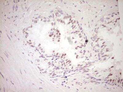 Immunohistochemistry-Paraffin: Dishevelled-2 Antibody (2D11) [NBP2-46480] - Analysis of Human prostate tissue. (Heat-induced epitope retrieval by 1 mM EDTA in 10mM Tris, pH8.5, 120C for 3min)