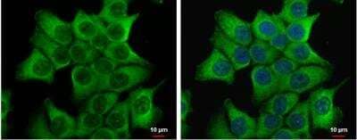 Immunocytochemistry/Immunofluorescence: Dishevelled-2 Antibody [NBP2-16168] - HCT 116 cells were fixed in 4% paraformaldehyde at RT for 15 min. Green: Dvl-2 protein stained by Dvl-2 antibody [N1N3] diluted at 1:500. Blue: Hoechst 33342 staining.