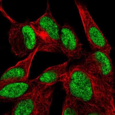 Immunocytochemistry/Immunofluorescence: Dishevelled-2 Antibody [NBP2-56345] - Staining of human cell line SH-SY5Y shows localization to nucleoplasm.